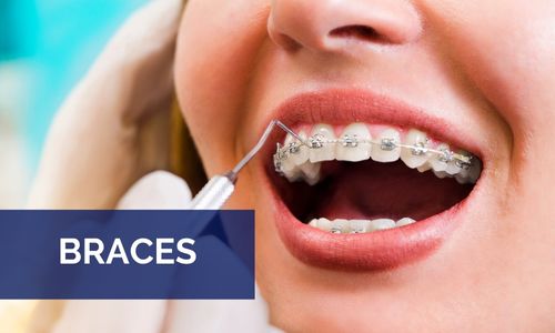 Braces in Greensboro NC